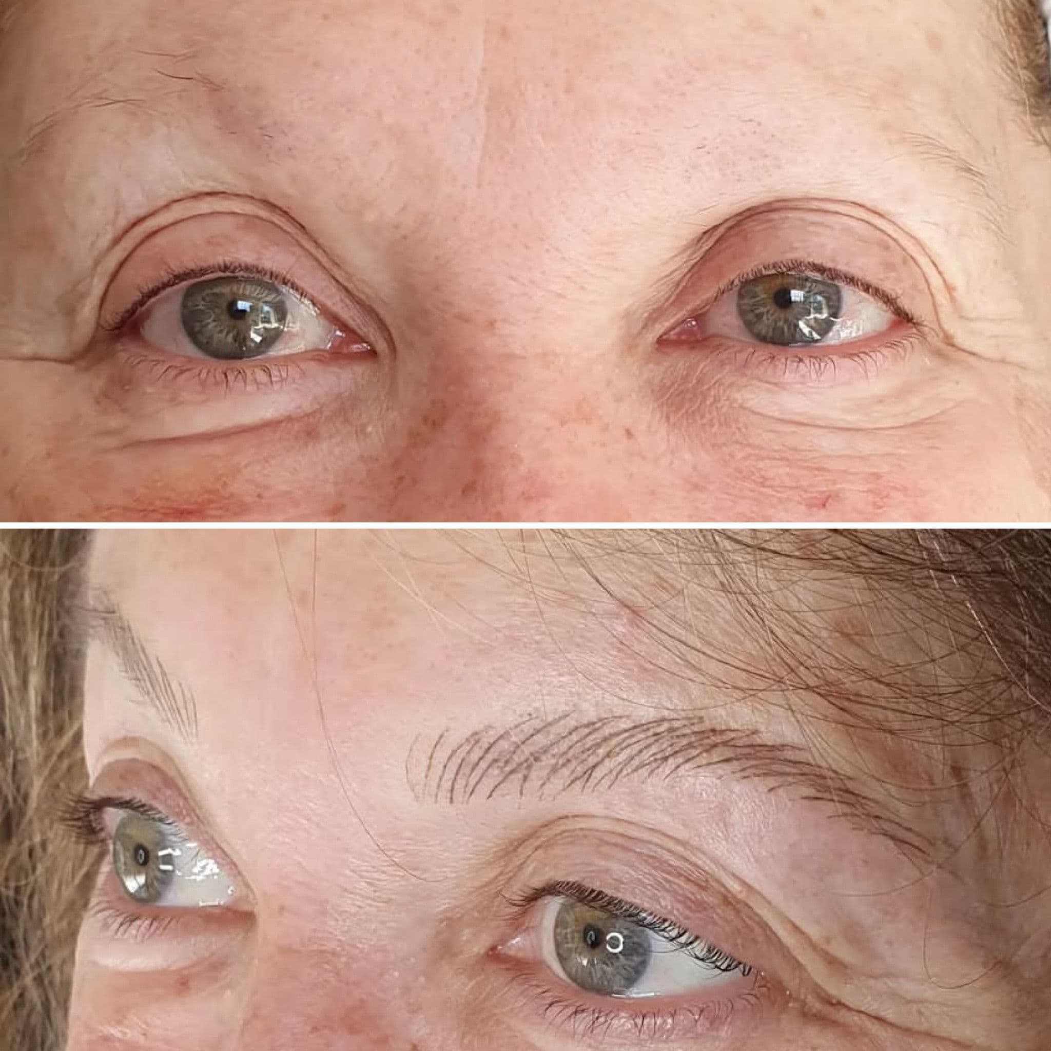 Cejas hiperrealistas en casos alopécicos - Imagen 2