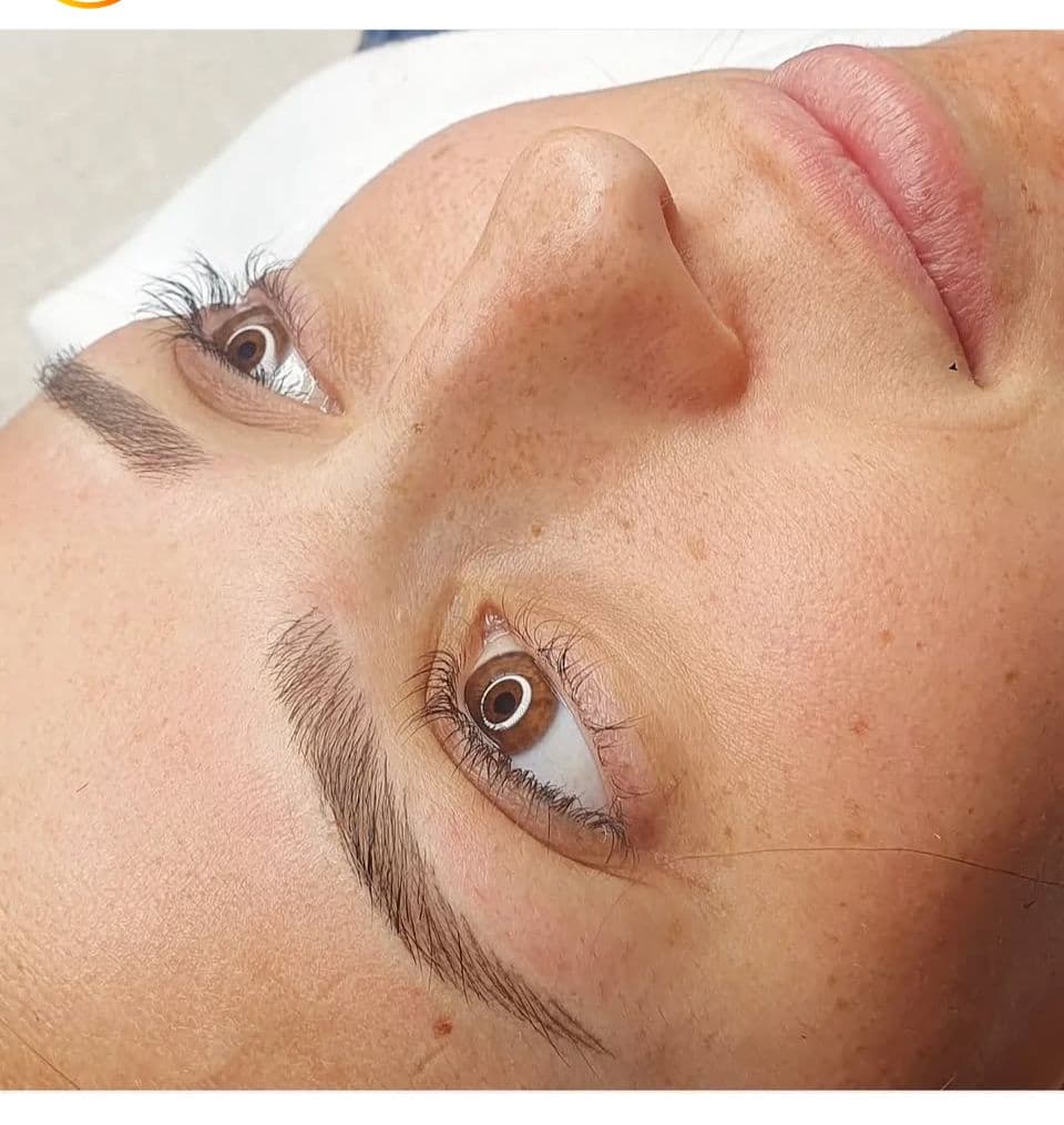 Dermo en cejas - Imagen 1