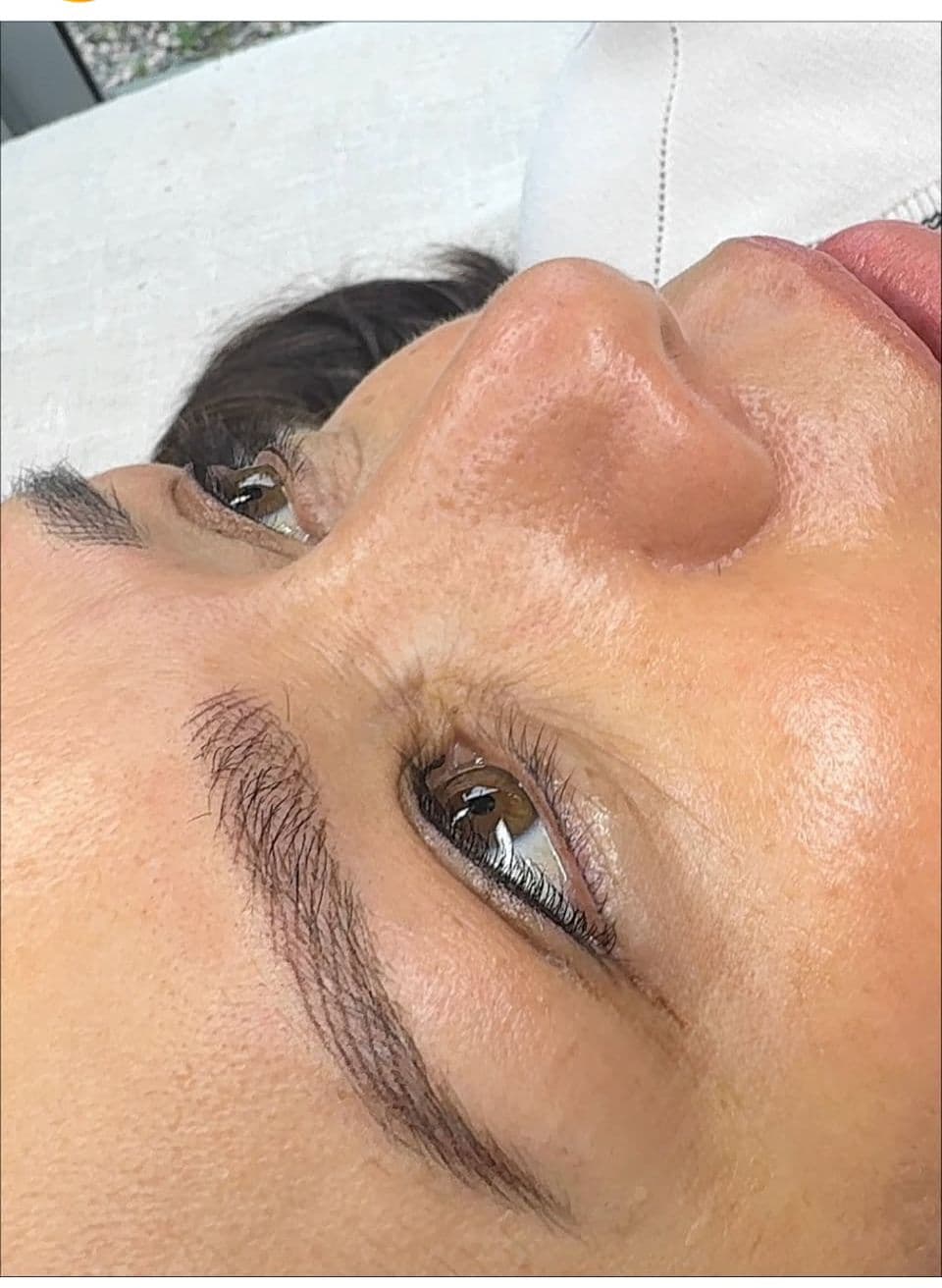 Dermo en cejas - Imagen 2