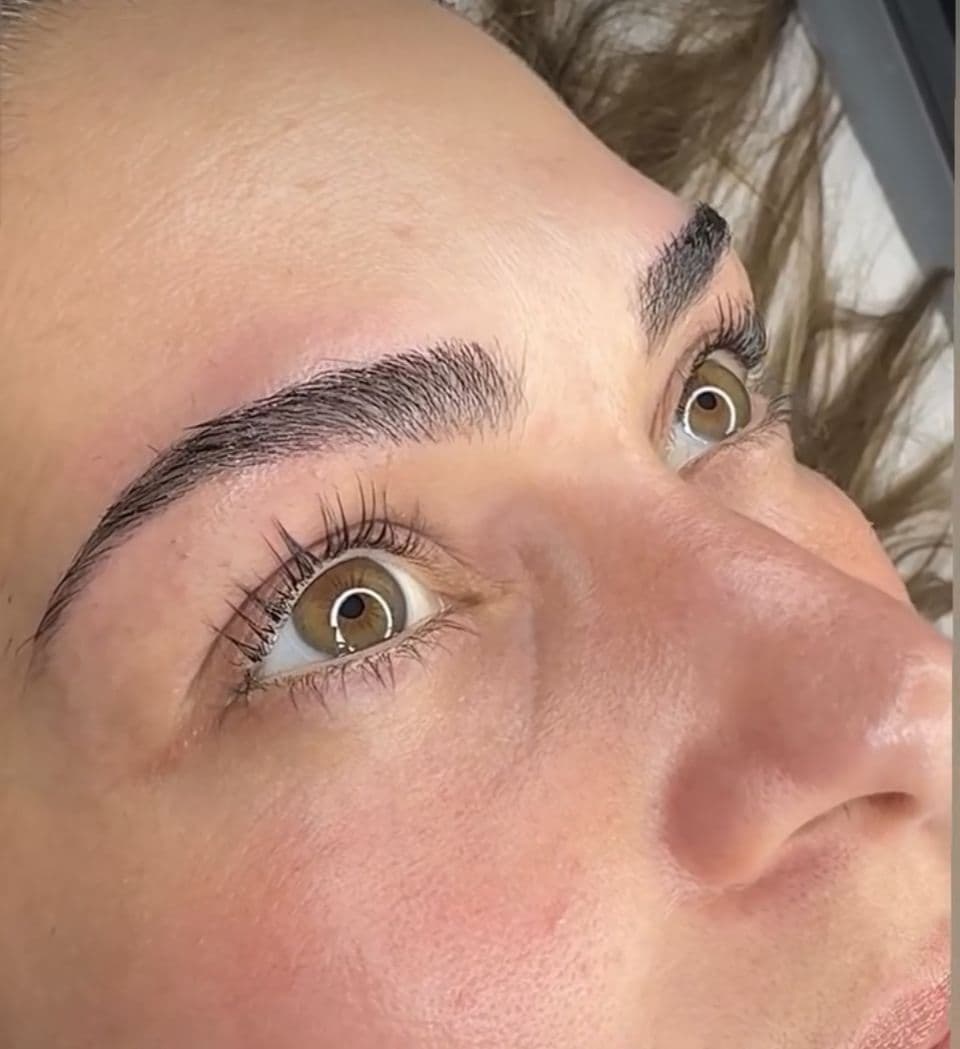 Dermo en cejas - Imagen 3