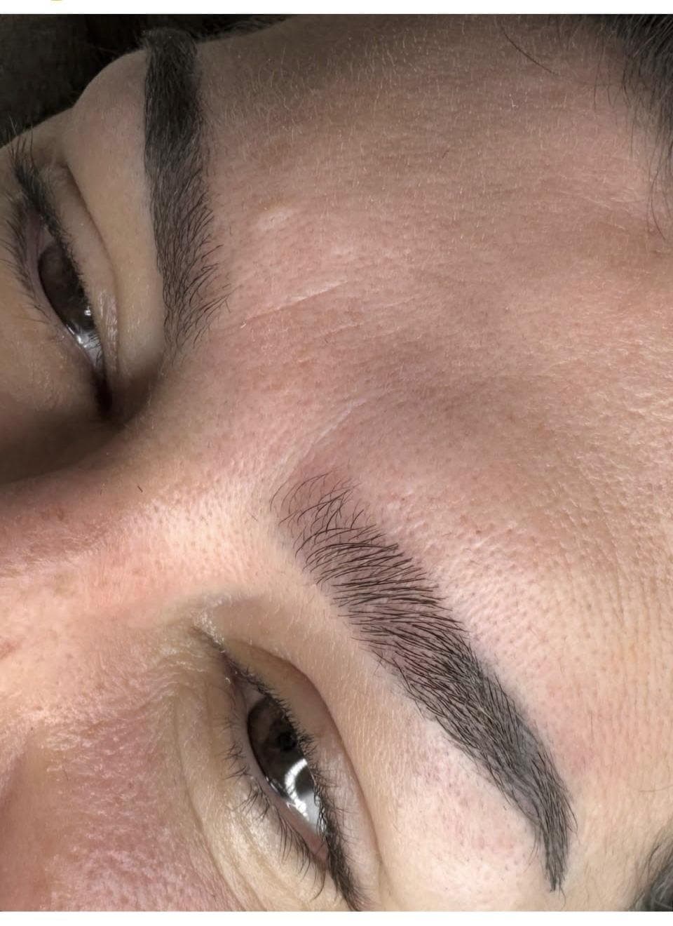 Dermo en cejas - Imagen 6