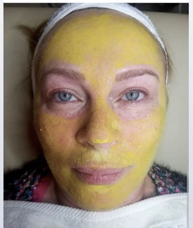 Skincare y peelings - Imagen 4